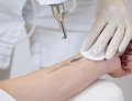 Laser Tattoo Removal – Safely Remove Unwanted Ink