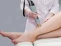 Laser Hair Removal – Smooth Skin, Zero Hassle